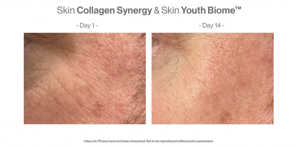 Skin collagen synergy & Skin youth biome before and after 14 days